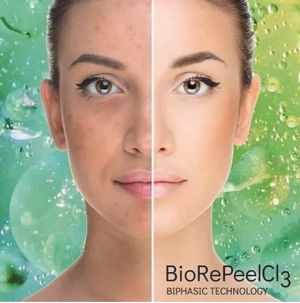 BioRePeelCl3 - Biorevitalizácia Intenzívne omladenie pleti