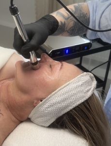 Biostimulačný lifting bez ihiel (bezihlová mezoterapia)