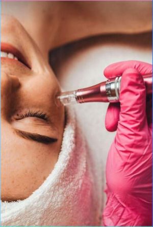 MICRONEEDLING (mezoterapia)