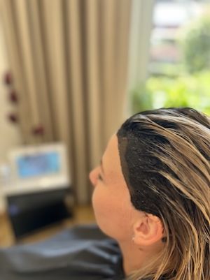 Vstupná konzultácia + procedúra