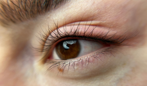 Medziriasová očná linka