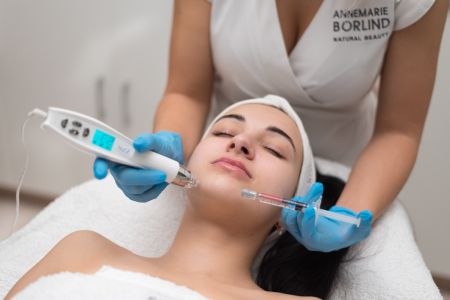 Mezoterapia