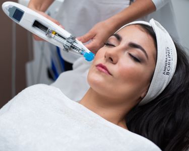 Mezoterapia