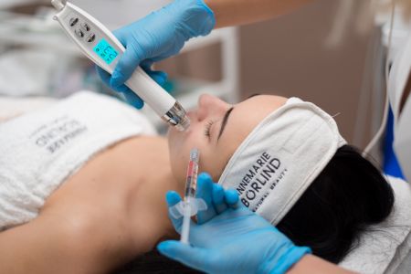 Mezoterapia