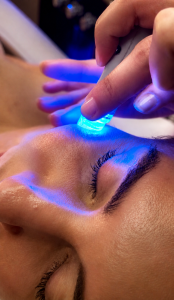 Hydrafacial + BioRePeel CI3 tvár 